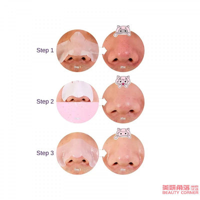 【自营】韩国HOLIKA HOLIKA惑丽客 猪鼻子3-STEP去黑头收缩毛孔 猪鼻贴 1件入